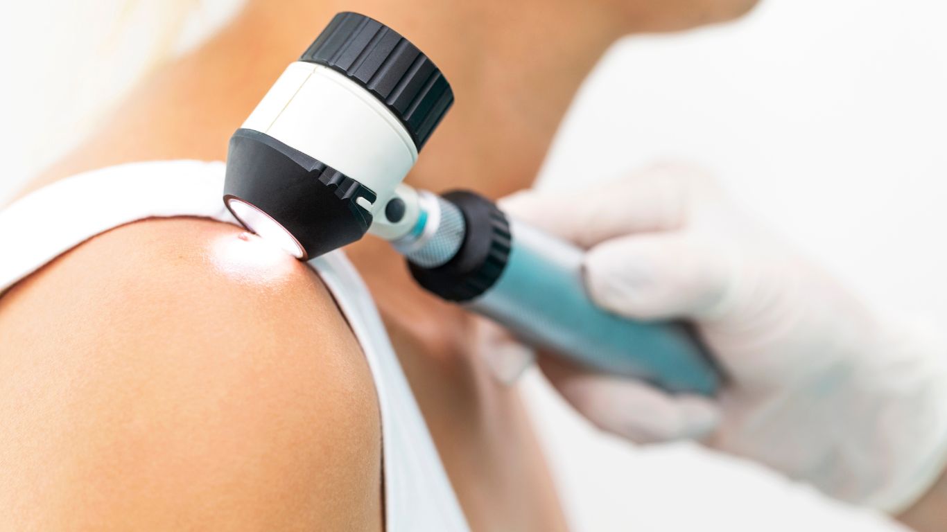 skin cancer guide by a qualified GP and skin doctor